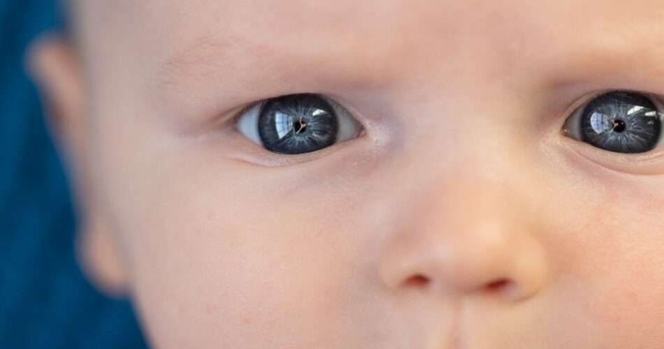 jedno oczko mniejsze u niemowlaka