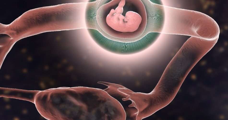 ciąża pozamaciczna